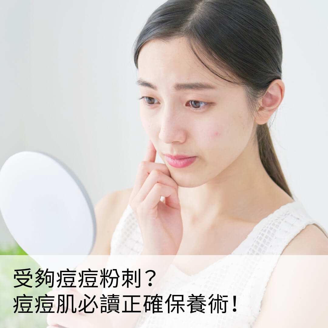 痘痘肌保養指南，掌握4不3保養原則，讓痘痘、粉刺不再困擾你